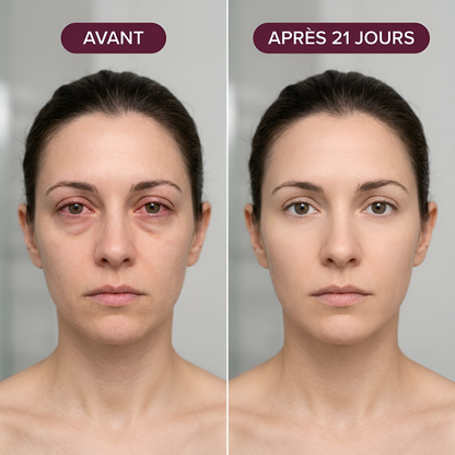 Somnio — Masque Masseur Oculaire Pro